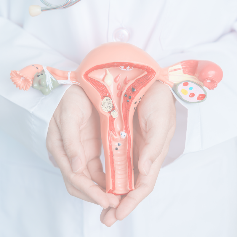 Síndrome dos ovários policísticos e infertilidade