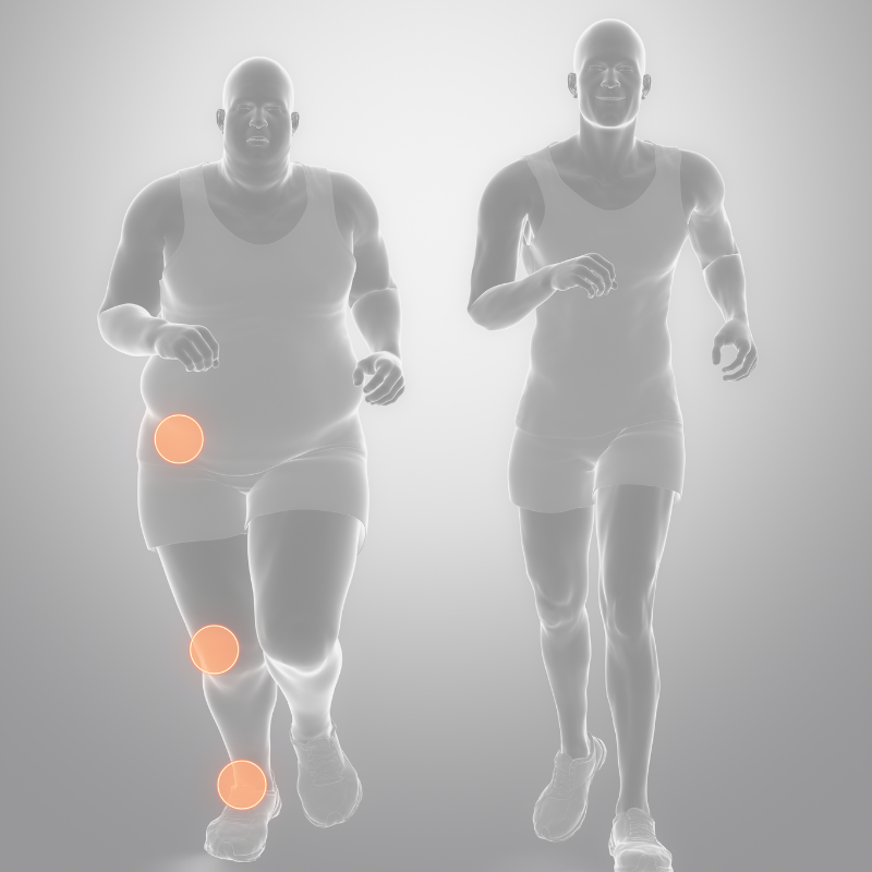 Obesidade e Sobrepeso